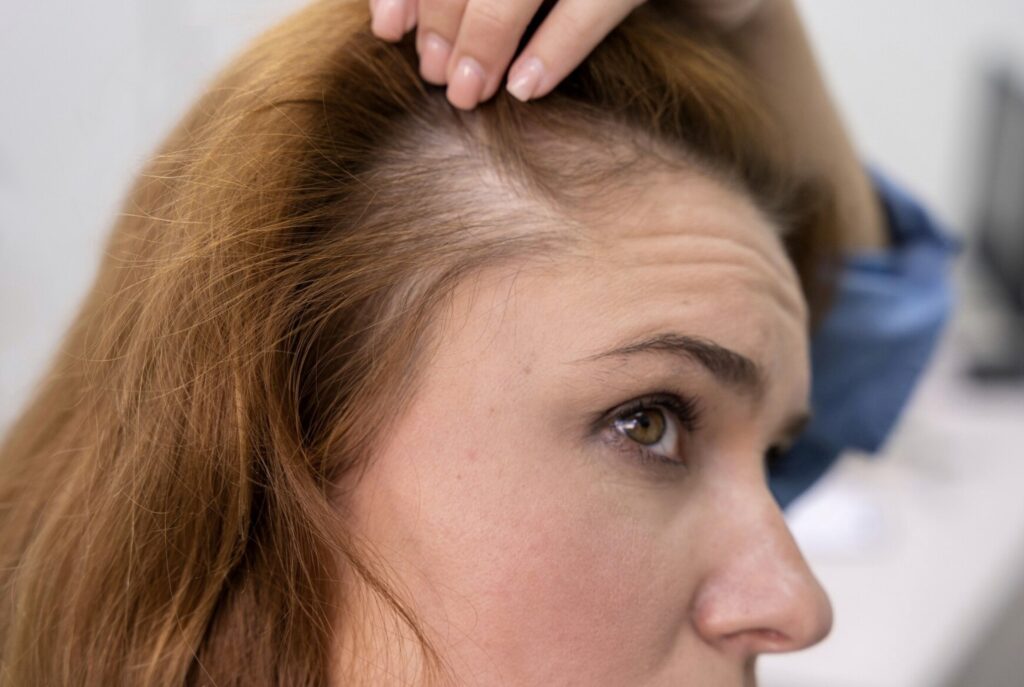 Common Causes of Hair Thinning