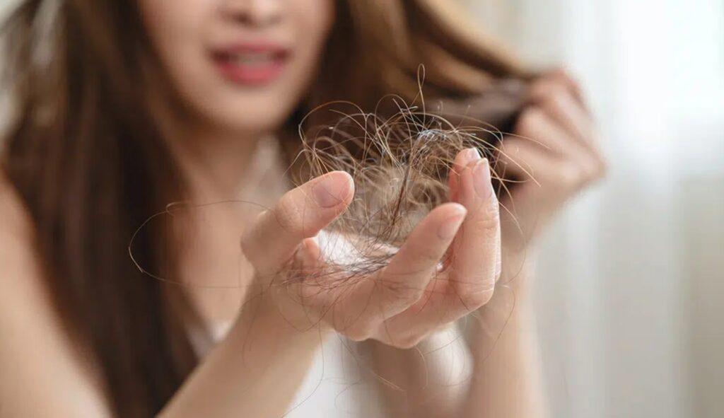 How to Manage and Prevent Hair Loss: A Comprehensive Guide 2 How to Manage and Prevent Hair Loss
